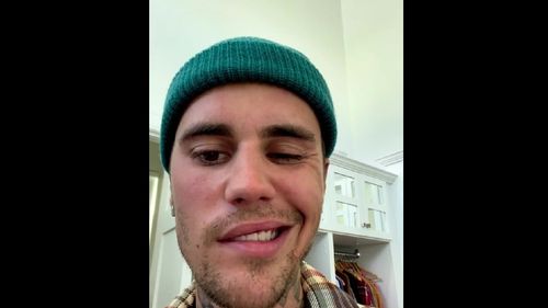 Cântărețul Justin Bieber a anulat mai multe concerte din cauza unei paralizii care îi afectează jumătate din faţă, generată de sindromul Ramsay Hunt