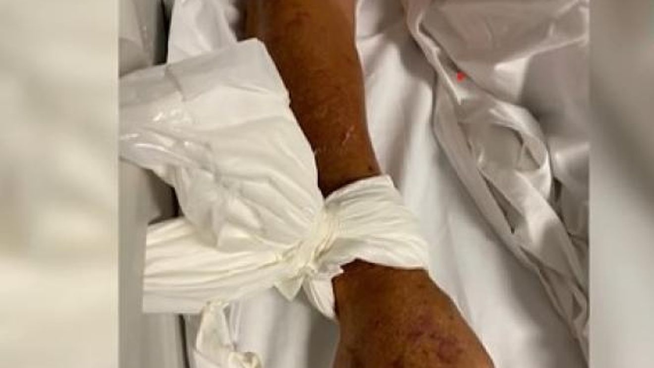 Anchetă în Italia după ce bolnavii dintr-un spital din Napoli erau legați de paturi / Infirmierii spun că exista teama că pacienții, persoane în vârstă, ar fi  putut cădea din pat