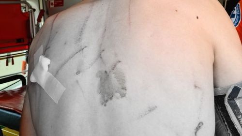 Harghita: Tânăr de 19 ani, atacat de urs / Victima a suferit răni uşoare, însă este vorba de un urs care a mai atacat