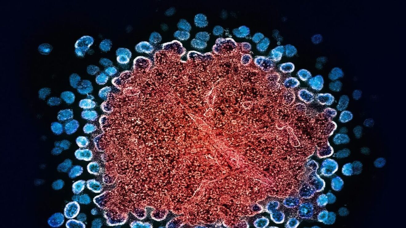 Un medicament împotriva infectării cu HIV, cea mai importantă descoperire ştiinţifică în 2024, potrivit revistei Science