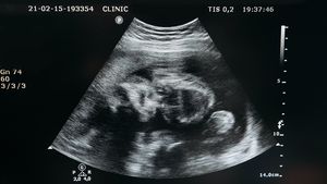 STUDIU Particule toxice prezente în aerul poluat, descoperite în premieră în plămânii şi creierul bebeluşilor nenăscuţi
