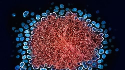 Cum cercetarea privind virusul HIV a remodelat medicina modernă: De la noi medicamente la tehnici de cercetare și cunoștințe esențiale pentru tratarea altor condiții