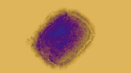 Variola maimuței: ECDC recomandă ca persoanele care se angajează în relații sexuale ocazionale sau cu mai mulți parteneri să fie prudente, iar cele cu simptome să se abțină de la relații sexuale / 35 de cazuri raportate în Europa și UK