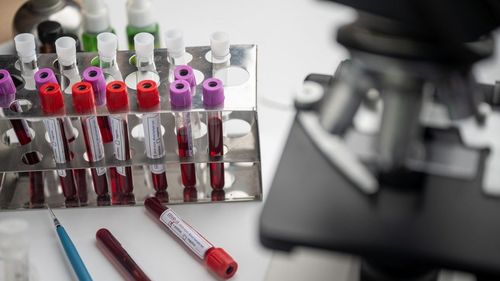 Sanofi şi GSK lansează un nou studiu clinic pentru o versiune reformulată a vaccinului împotriva COVID-19