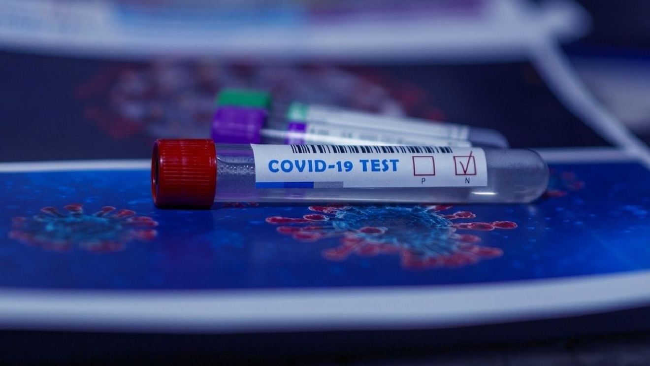 1.931 cazuri noi COVID în ultimele 24 de ore, cu peste 1.100 mai puține decât în ziua anterioară