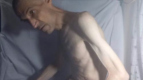 Imagini cu un deţinut iranian emaciat stârnesc indignare, după ce a slăbit 52 de kg / Medicul Farhad Meysami, în vârstă de 53 de ani, e închis din 2018, iar din 7 octombrie 2022 se află în greva foamei
