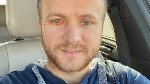 Activistul de mediu Daniel Bodnar, rănit grav într-un accident rutier. Diagnosticul preliminar: fractură de coloană lombară și paraplegie