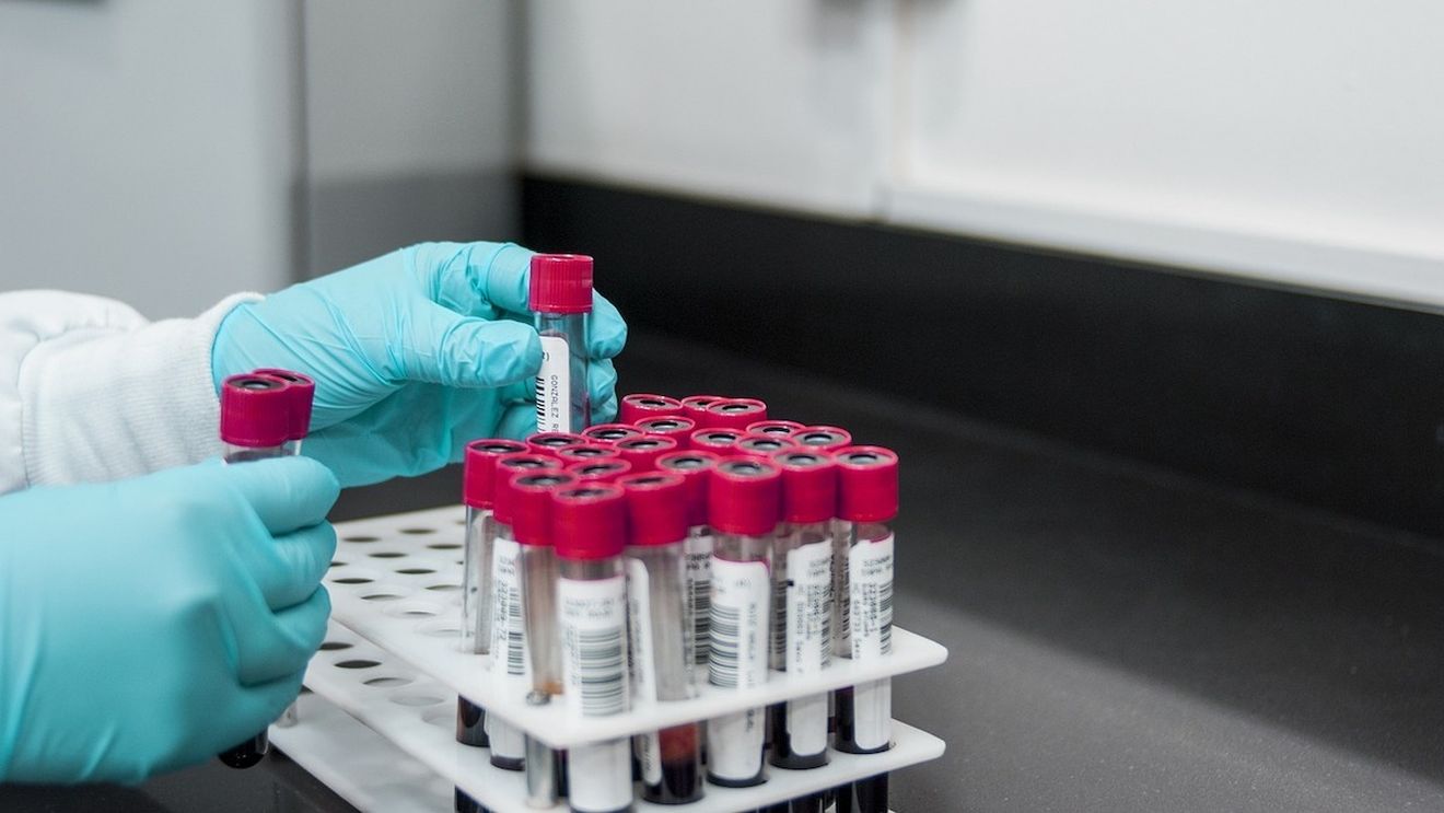 O şcoală din Germania a fost închisă după ce noua variantă de mpox a fost depistată la doi elevi