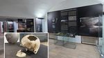 Operație reușită pe creier, veche de 4.500 de ani, în expoziția Muzeului Național al Unirii din Alba Iulia. Craniul trepanat de la Livezile, una dintre cele mai spectaculoase descoperiri preistorice din România. Ce arată studiile antropologice