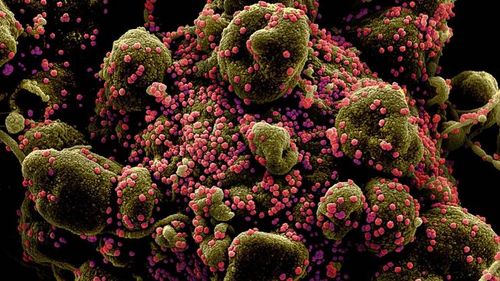 O nouă tulpină de Coronavirus detectată pentru prima dată în Brazilia a fost identificată acum și în Marea Britanie. Șase persoane infectate