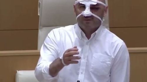 "Aceste semne de pe corpul meu sunt urmele Rusiei": Un deputat georgian apare în Parlament după ce a fost bătut la o manifestație pro-UE