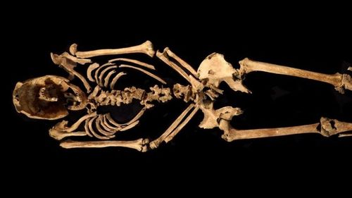 O descoperire din Indonezia atestă că cea mai veche intervenție chirurgicală ar fi avut loc în urmă cu 31.000 de ani/ Tânărul a supraviețuit între 6 și 9 ani de la operație