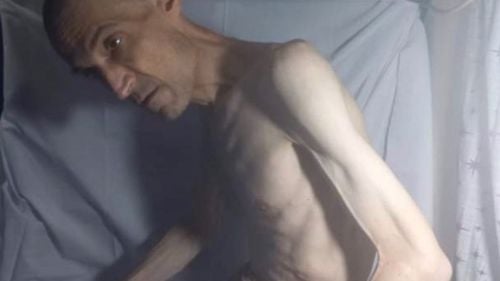 Imagini cu un deţinut iranian emaciat stârnesc indignare, după ce a slăbit 52 de kg / Medicul Farhad Meysami, în vârstă de 53 de ani, e închis din 2018, iar din 7 octombrie 2022 se află în greva foamei