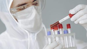 A fost depășit pragul de 8 milioane de infectări cu COVID-19 la nivel mondial. Peste 435.000 de persoane au murit