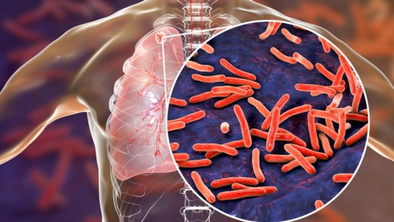 Studiu: Simplul act de a respira poate fi un mod major de transmitere a tuberculozei