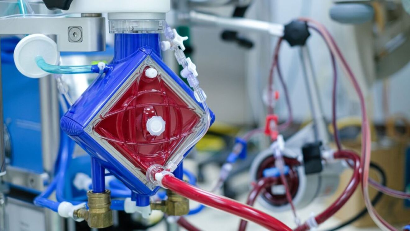 Un bărbat din Iași, găsit în hipotermie, a fost salvat printr-o tehnică ce este aplicată în doar două spitale din țară / A beneficiat de oxigenare extracorporeală cu membrană (ECMO) / Bărbatul avea 23°C și era fără activitate cardiacă, respiratorie și cerebrală