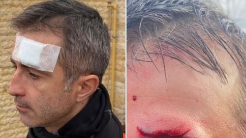 Europarlamentarul PSD Dragoş Benea, rănit după ce a intrat cu bicicleta într-un autoturism. El susține că o maşină i-a tăiat calea