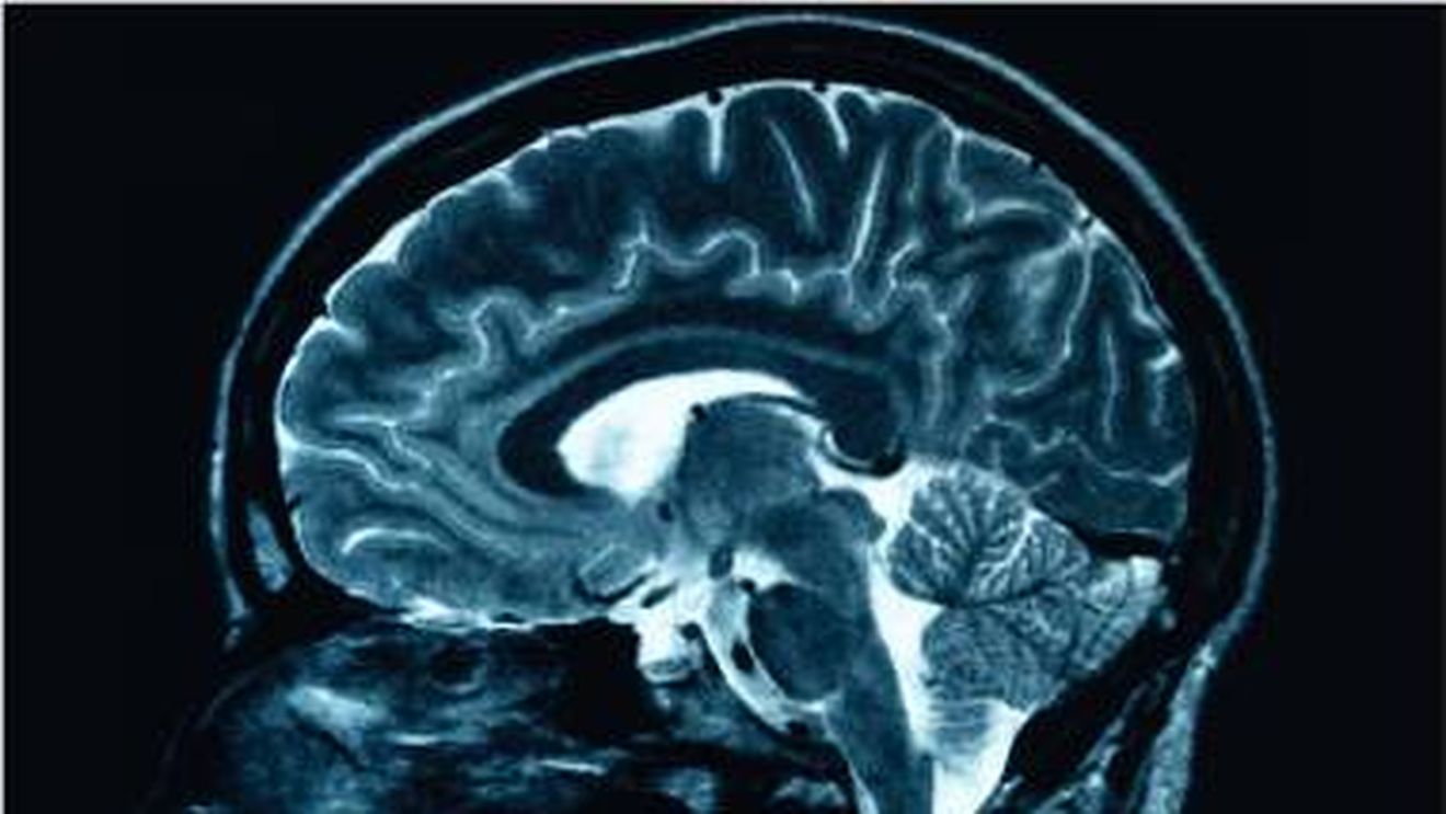 Ar putea acest medicament revoluționar să oprească simptomele Alzheimer? / Exclusivitate Sunday Times