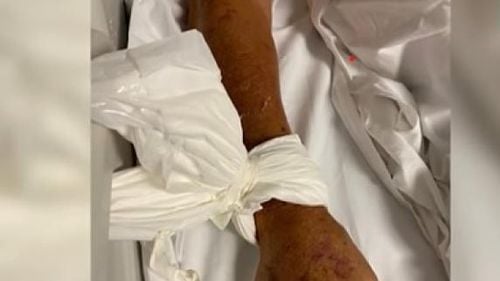 Anchetă în Italia după ce bolnavii dintr-un spital din Napoli erau legați de paturi / Infirmierii spun că exista teama că pacienții, persoane în vârstă, ar fi  putut cădea din pat