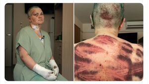 Ziarista Elena Milashina, după atacul brutal din Cecenia: Traumatism cranian, multiple fracturi la mâini