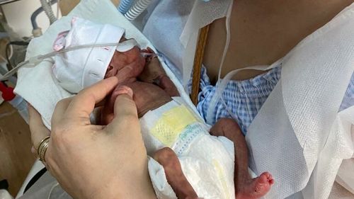 Ziua Mondială a Prematurității: Cel mai mic dintre bebeluşii născuți în 2022 la Spitalul Universitar din București a cântărit sub 500 de grame