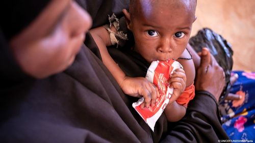 UNICEF avertizează în legătură cu niveluri „catastrofale” de malnutriţie infantilă cauzate de majorarea preţurilor şi de războiul din Ucraina