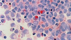 STUDIU Cercetătorii maghiari anunță că au dezvoltat un medicament împotriva cancerului / A vindecat complet șoarecii de laborator cu un singur tratament